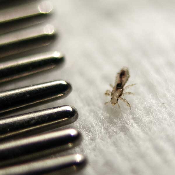 Cómo eliminar los piojos OCU